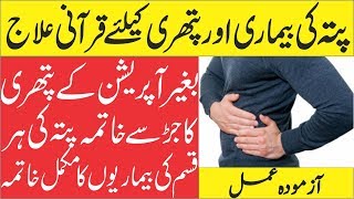 Pitte Ki Bimari Aor Pathri Ka Wazifa  Gall Bladder Stone Treatment  Qurani Wazifa  Naqsh e Shifa [upl. by Alyled]