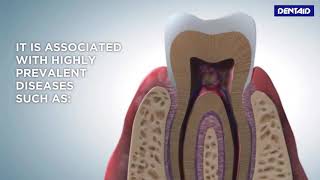 What is oral biofilm [upl. by Nevai]