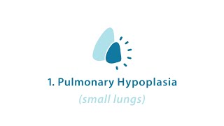 CDH Part 2 CDH Pulmonary Hypoplasia [upl. by Woods806]