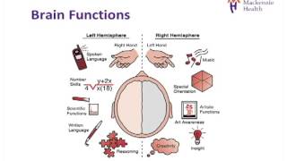 Stroke Education  Causes and Effects [upl. by Nissie]