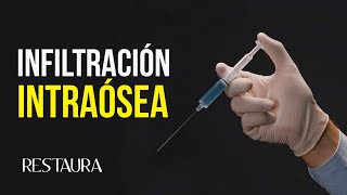 ¿Para qué sirve la infiltración intraósea [upl. by Phail184]