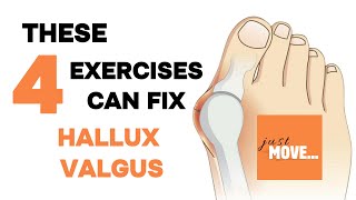 Hallux Valgus Exercises  no equipment  follow along  building up the arch of the foot [upl. by Materi]