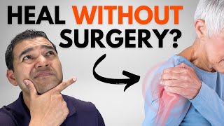 Can a Shoulder Labrum Tear ACTUALLY Heal Naturally Without Surgery [upl. by Tomlin]