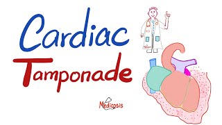 Cardiac Tamponade  Causes Symptoms Signs Diagnosis amp Treatment  Cardiology Series [upl. by Aubrie]