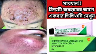 Betnovate n skin cream  বেটনোভেট এন ক্রিম এর কাজ কি ত্বক ফর্সাকারী ক্রিম  Betnovate N Cream [upl. by Trometer636]