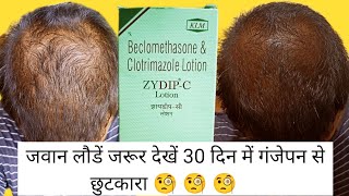 How to Apply Zydip C Lotion on Scalp How to Use Zydip C Lotion Officialprakashtip haircare [upl. by Maggy460]