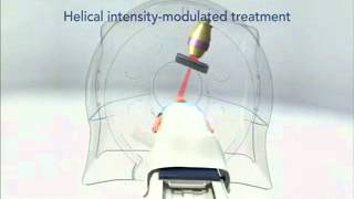 Overview TomoTherapy [upl. by Teak]