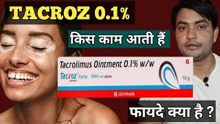 tacroz forte 01 ointment  tacroz ointment 01  use in hindi [upl. by Adnowat679]