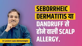 Seborrheic dermatitis या Dandruff से होने वाली scalp allergy Dr sandesh Gupta 9990804085 [upl. by Norod10]