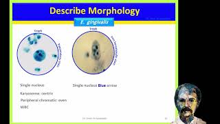 Diagnostic Parasitology Entamoeba gingivalis Naegleria fowleri Balamuthia and Acanthamoeba [upl. by Lynelle792]