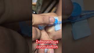 Intravenous cannula fix  shorts yrendingshortsonyoutube doctor trending SMpharmacy [upl. by Morril880]