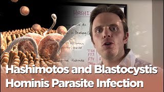 Hashimotos and Blastocystis Hominis Parasite Infection  The Infection Connection [upl. by Anselmi]