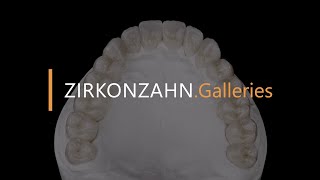 Complete restoration made with Prettau® 4 Anterior® zirconia  ZirkonzahnGalleries [upl. by Archambault196]