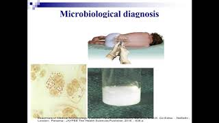 Gram negative cocci Microbiology [upl. by Daile]