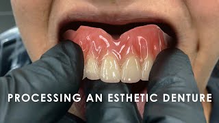 How to Process an Esthetic Denture [upl. by Snider]