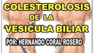 COLESTEROLOSIS DE LA VESÍCULA BILIAR  GRASAS EN LA VESÍCULA BILIAR [upl. by Alimaj]