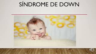 HidrocefaliaLabio Leporino Sindrome de Down [upl. by Nainatrad]