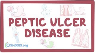 Peptic ulcer disease  causes symptoms diagnosis treatment pathology [upl. by Anilasor]