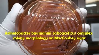 Acinetobacter baumannii calcoaceticus complex colony morphology on Macconkey agar [upl. by Tesil]