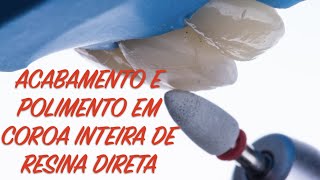 Tutorial de acabamento e polimento de uma coroa feita em resina direta [upl. by Ybab]