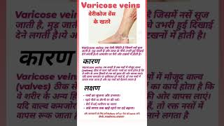 Varicose veins 😲 doctor [upl. by Eecrad]