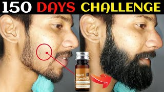 Ustraa Beard Growth Oil After 150 Days Review  Best Beard Oil For Patchy Beard in India 2024 [upl. by Adliwa]