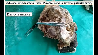 Ischioanal or Ischiorectal fossa Pudendal nerve amp Internal pudendal artery dissection Demonstration [upl. by Anerres387]