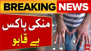 Monkeypox Cases Increasing in Pakistan  Alert Issued  Breaking News [upl. by Jamison]