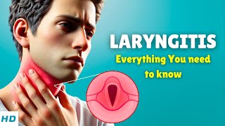 Laryngitis Losing Your Voice – Causes Signs and Symptoms Diagnosis amp Treatment [upl. by Inej779]