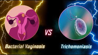 Bacterial Vaginosis vs Trichomoniasis  Differences between Bacterial Vaginosis and Trichomoniasis [upl. by Furlani]