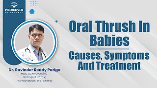 Oral Thrush In Babies Causes Symptoms And Treatment  Medicover Hospitals [upl. by Oulman471]