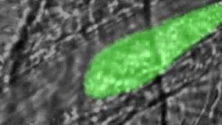 Real time thrombus formation after a laserinduced injury [upl. by Nido636]