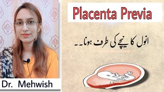 placenta previa treatment  low lying placenta in pregnancy  mommy expertise [upl. by Leanna]