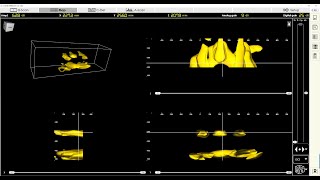 MIRA NEO DESKTOP  Application Software for acquisition and analysis of UT data of A1040 MIRA 3D [upl. by Aisitel13]