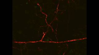 Arbuscular Mycorrhizal Symbiosis extraradical lipid flow 1 Live Imaging [upl. by Breger]