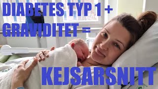 GRAVID med diabetes typ 1 och MS  Föder barn nr 2 med KEJSARSNITT [upl. by Randal]