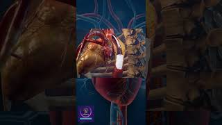 Heart Surgery Angioplasty shorts viral [upl. by Gipsy]