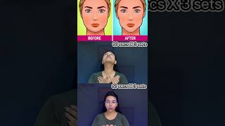 Face Exercises to lose Face Fat shorts facefatloss faceexercise [upl. by Arva]