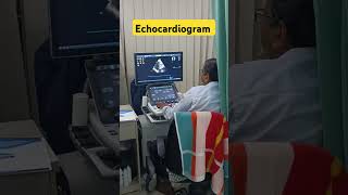 Echocardiogram viral health medicalstudent health [upl. by Goodard]