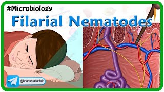 Filarial nematodes Animation🐛 Wuchereria onchocera volvulus LoaLoa Dracunculus Trichinella [upl. by Elisha916]