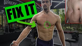 My Favourite Exercise for Pectus Excavatum [upl. by Oag]