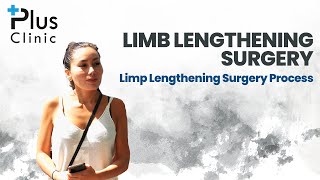 Limb Lengthening Surgery Process in Turkey  Plus Clinic [upl. by Dotson]