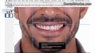 DSD  Digital Smile Design by Felipe Miguel [upl. by Rett501]