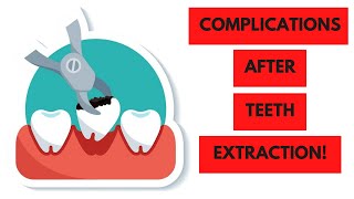 Postoperative Teeth Extraction Complications From Diagnosing to Management [upl. by Novj]