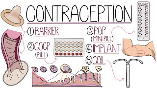 Methods of Contraception Made Easy Contraceptive Methods Explained [upl. by Alger]