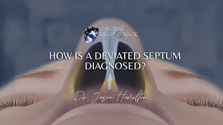 How is a deviated septum diagnosed [upl. by Eanwahs]