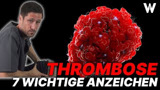 Lebensgefahr Thrombose 7 Warnzeichen und wichtige Tipps gegen Thrombosen [upl. by Budd]