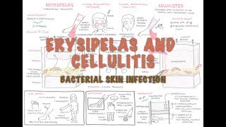 Bacterial Skin Infection  Cellulitis and Erysipelas Clinical Presentation Pathology Treatment [upl. by Ylrehc161]