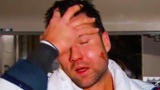 Tom Wilsons Face Injury SEVERELY SWOLLEN after Puck to the Face  Capitals vs Canadiens Highlights [upl. by Adnahsam]