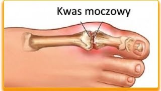 Owoce obniżające poziom kwasu moczowego we krwi [upl. by Idyak203]